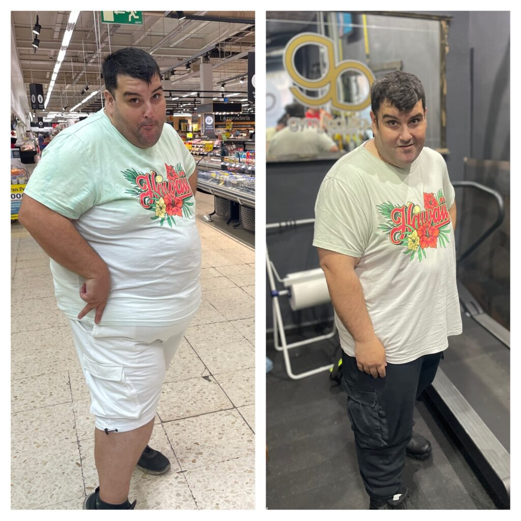 Foto Jose antes y despues del 21 de marzo